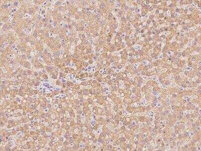 Immunohistochemistry-Paraffin: SLC25A2 Antibody [NBP3-06289]