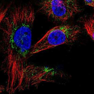 Immunocytochemistry/ Immunofluorescence: SLC25A20 Antibody [NBP1-86689]