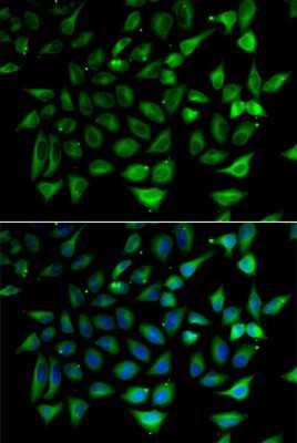 Immunocytochemistry/ Immunofluorescence: SLC25A20 Antibody - Azide and BSA Free [NBP3-04656]