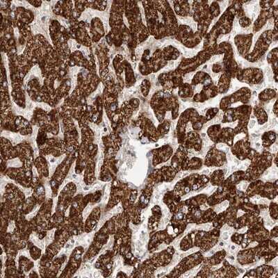 Immunohistochemistry-Paraffin: SLC25A20 Antibody [NBP1-86689]