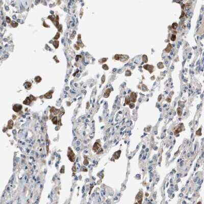 Immunohistochemistry-Paraffin: SLC25A20 Antibody [NBP1-86690]