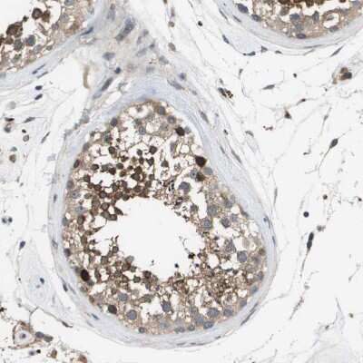Immunohistochemistry-Paraffin: SLC25A20 Antibody [NBP1-86690]