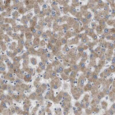Immunohistochemistry-Paraffin: SLC25A20 Antibody [NBP1-86690]