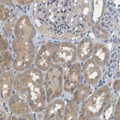Immunohistochemistry-Paraffin: SLC25A20 Antibody [NBP1-86690]