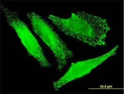 Immunocytochemistry/ Immunofluorescence: SLC25A20 Antibody (M2) [H00000788-M02]