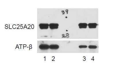 Western Blot: SLC25A20 Antibody [NBP1-86690]
