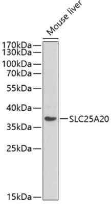 Western Blot: SLC25A20 AntibodyAzide and BSA Free [NBP2-94292]