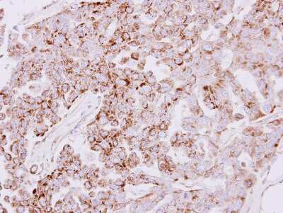 Immunohistochemistry-Paraffin: SLC25A22 Antibody [NBP1-33385]