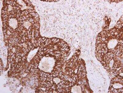 Immunohistochemistry-Paraffin: SLC25A22 Antibody [NBP1-33385]