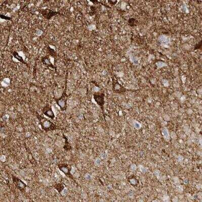 Immunohistochemistry-Paraffin: SLC25A22 Antibody [NBP1-84880]