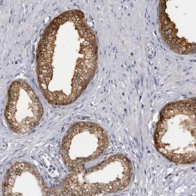 Immunohistochemistry-Paraffin: SLC25A22 Antibody [NBP1-84880]