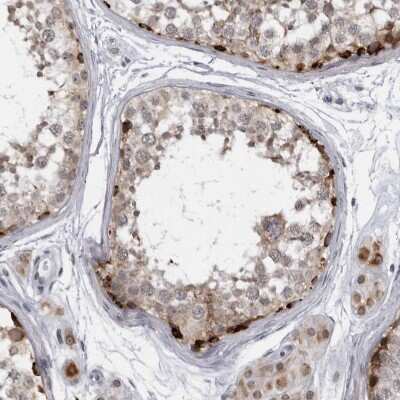 Immunohistochemistry-Paraffin: SLC25A22 Antibody [NBP1-84880]