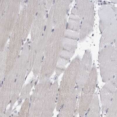 Immunohistochemistry-Paraffin: SLC25A22 Antibody [NBP1-84880]