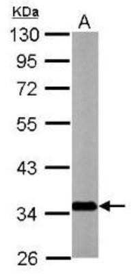 Western Blot: SLC25A22 Antibody [NBP1-33385]