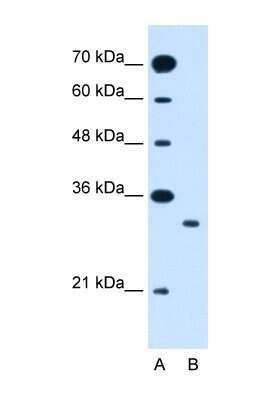 Western Blot: SLC25A22 Antibody [NBP1-59603]