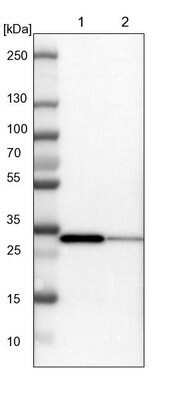 Western Blot: SLC25A22 Antibody [NBP1-84880]
