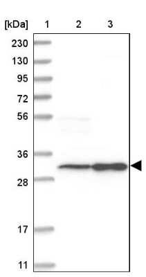 Western Blot: SLC25A22 Antibody [NBP1-84880]