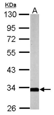 Western Blot: SLC25A22 Antibody [NBP2-20388]