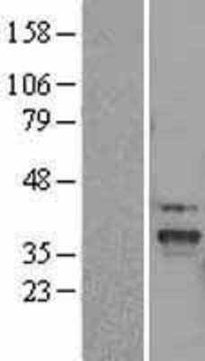 Western Blot: SLC25A22 Overexpression Lysate [NBL1-16055]