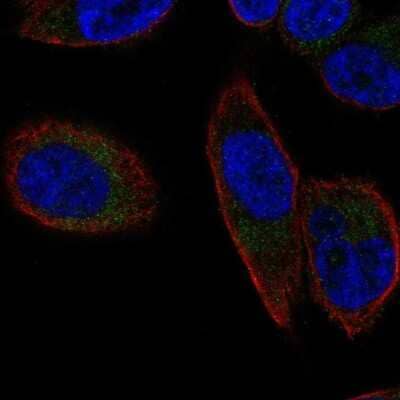 Immunocytochemistry/ Immunofluorescence: SLC25A23 Antibody [NBP2-58927]