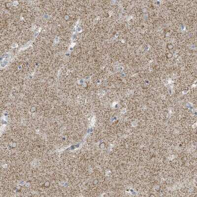 Immunohistochemistry-Paraffin: SLC25A23 Antibody [NBP2-13321]
