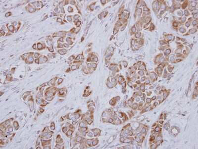 Immunohistochemistry-Paraffin: SLC25A23 Antibody [NBP2-20389]