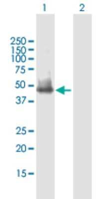 Western Blot: SLC25A23 Antibody [H00079085-B01P]