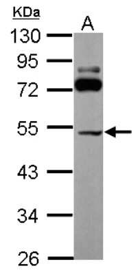 Western Blot: SLC25A23 Antibody [NBP2-20389]
