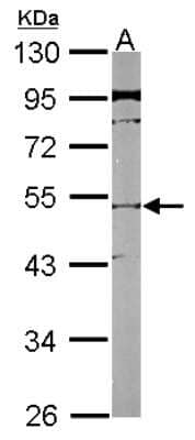 Western Blot: SLC25A23 Antibody [NBP2-20389]