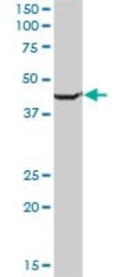 Western Blot: SLC25A24 Antibody [H00029957-B01P]