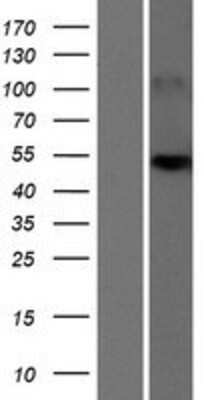 Western Blot: SLC25A24 Overexpression Lysate [NBP2-04468]