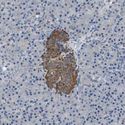 Immunohistochemistry-Paraffin: SLC25A25 Antibody [NBP1-82886]