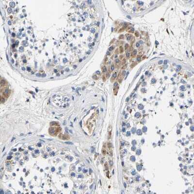 Immunohistochemistry-Paraffin: SLC25A25 Antibody [NBP1-82886]