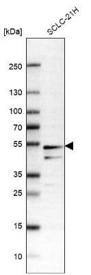 Western Blot: SLC25A25 Antibody [NBP1-82886]