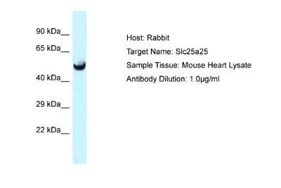 Western Blot: SLC25A25 Antibody [NBP2-88290]