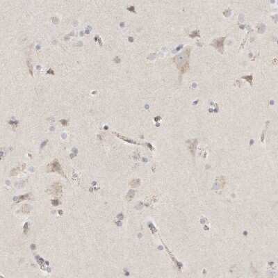Immunohistochemistry-Paraffin: SLC25A26 Antibody [NBP1-90881]