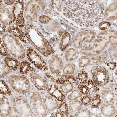 Immunohistochemistry-Paraffin: SLC25A26 Antibody [NBP1-90881]