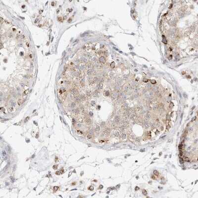 Immunohistochemistry-Paraffin: SLC25A26 Antibody [NBP1-90881]