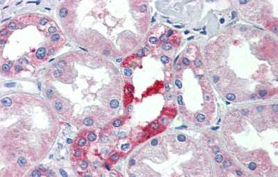 Immunohistochemistry-Paraffin: SLC25A28 Antibody [NBP1-59562]