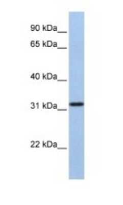 Western Blot: SLC25A28 Antibody [NBP1-59562]