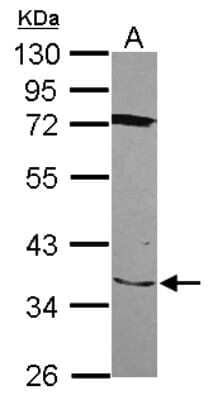 Western Blot: SLC25A28 Antibody [NBP2-20390]