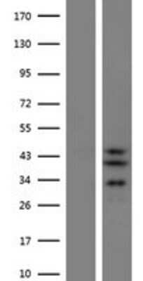 Western Blot: SLC25A28 Overexpression Lysate [NBP2-06146]