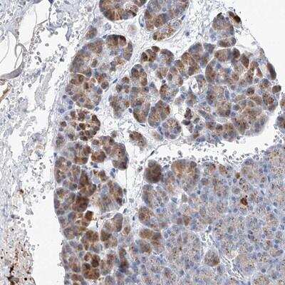 Immunohistochemistry-Paraffin: SLC25A29 Antibody [NBP1-88425]