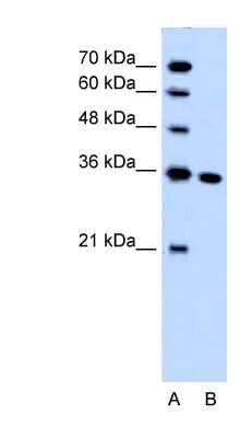 Western Blot: SLC25A29 Antibody [NBP1-59499]