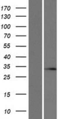 Western Blot: SLC25A29 Overexpression Lysate [NBP2-08569]