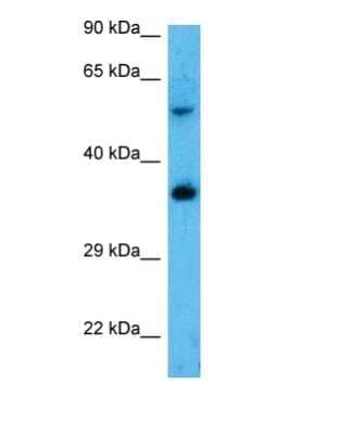 Western Blot: SLC25A3 Antibody [NBP2-86810]