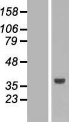 Western Blot: SLC25A3 Overexpression Lysate [NBL1-16058]