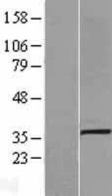 Western Blot: SLC25A3 Overexpression Lysate [NBL1-16059]