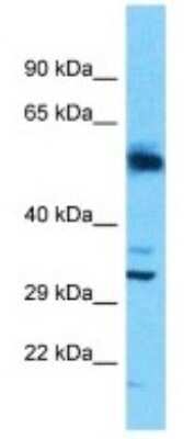 Western Blot: SLC25A30 Antibody [NBP3-10573]