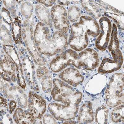 Immunohistochemistry-Paraffin: SLC25A31 Antibody [NBP1-89073]
